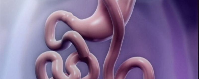 CNN.com: Weight loss interventions that work: Surgery